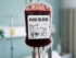 Blood transfusion bag labeled Pure Blood containing whole blood with anticoagulant